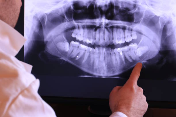 Best Emergency Dental Services for Seniors in Drexel Hill, PA